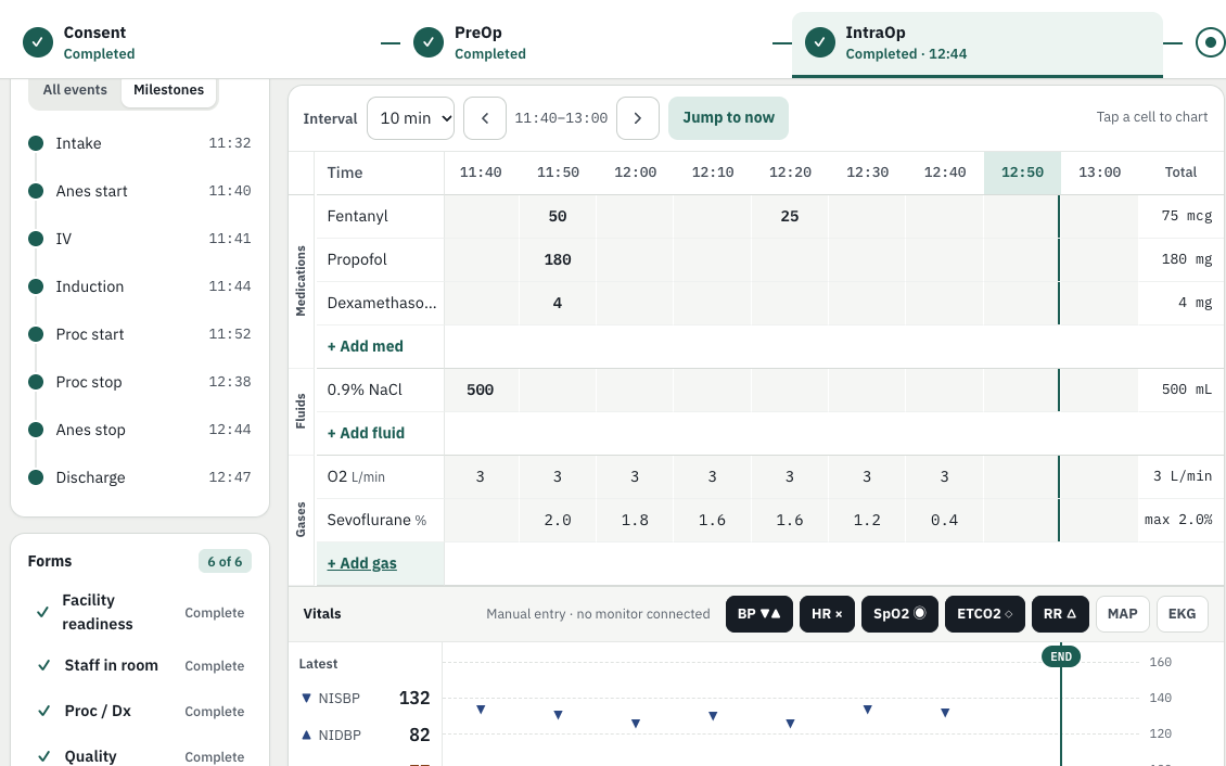 PulseOne intra-op anesthesia record with a medication, fluid and gas grid above a vital-signs chart